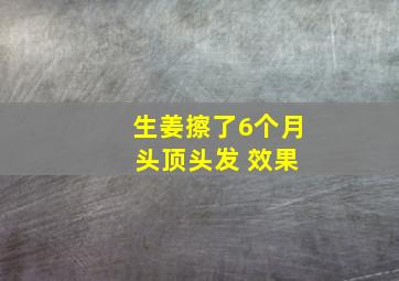 生姜擦了6个月 头顶头发 效果